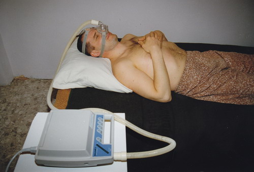 Patsiendi rolli asetatud kõrva-nina-kurguarst dr Margus Luht demonstreerib tolleaegse CPAP-aparaadi kasutamist. Foto: psühhiaatriakliiniku arhiiv.
