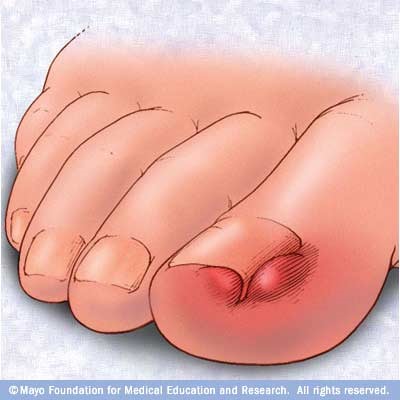 12 эффективных способов восстановления ногтевой пластины